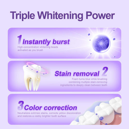【Buy 1, Get 1 Free】Miss Magic Purple Toothpaste– Advanced Color-Correcting Whitening, Stain Removal, Long-Lasting Fresh Breath, Brightens Yellow Teeth, Supports Oral Health
